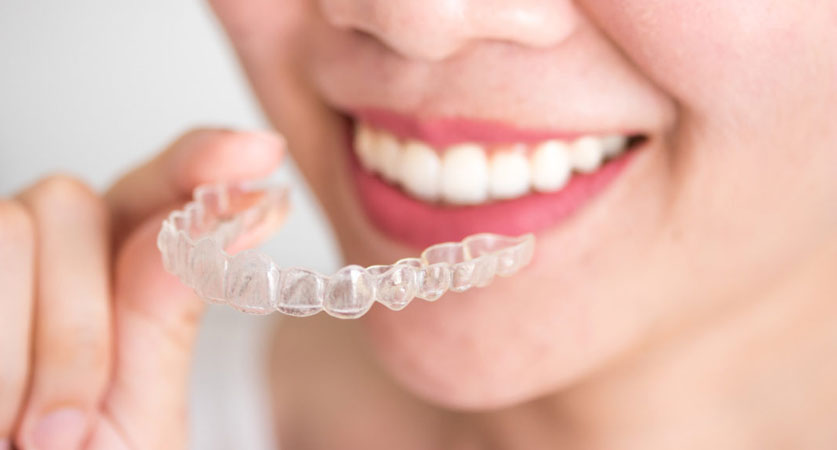 Invisalign braces