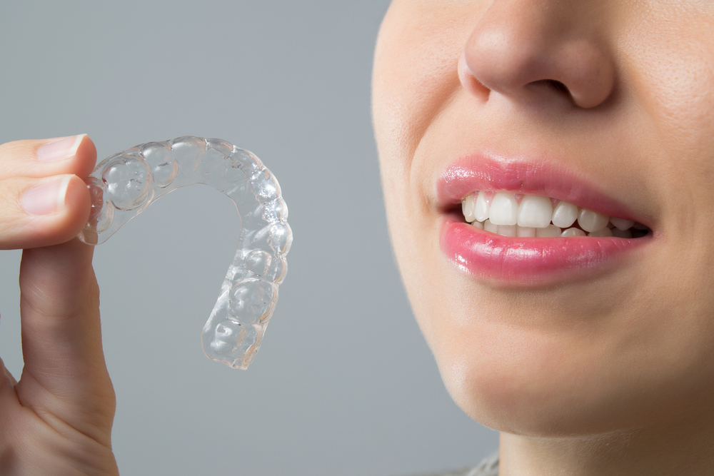 best Invisalign doctor