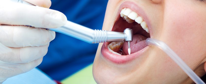 root canal treatment