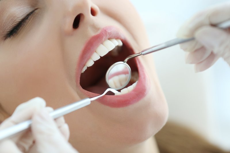 Deep Teeth Cleaning