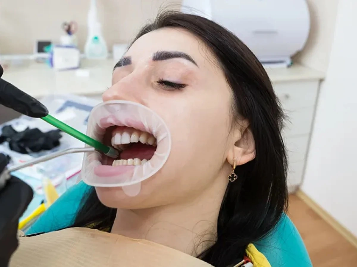 Albany Dentist WA