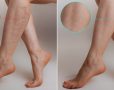 health_image